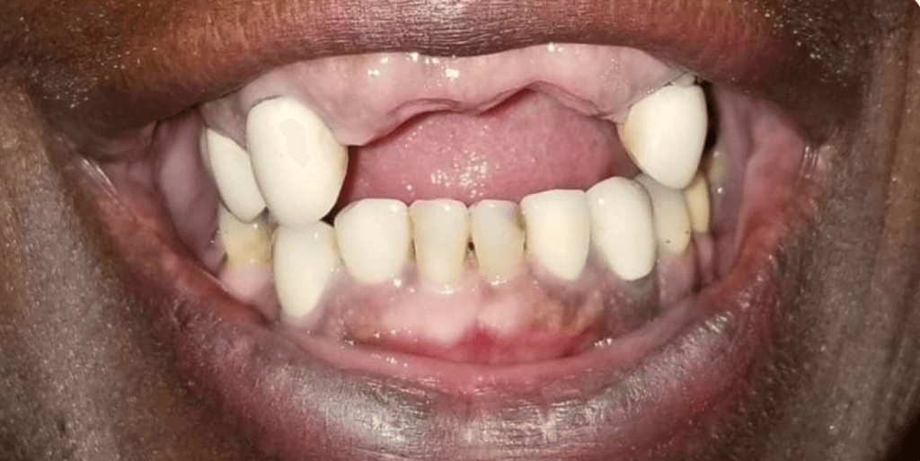 Before smile treatment