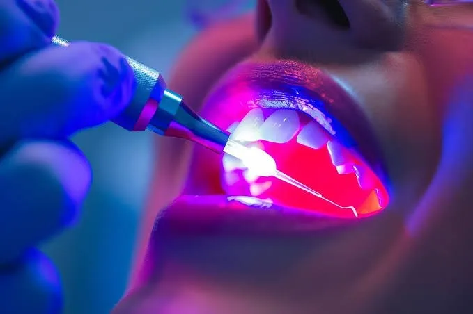 የሌዘር ጥርስ ሕክምና Treatment at Green Life Dental