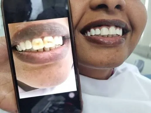 የውበት መልሶ ግንባታ Treatment at Green Life Dental