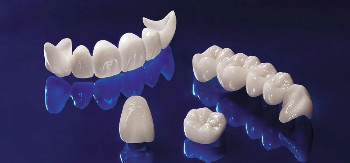 የጥርስ ሽፋንና ድልድይ Treatment at Green Life Dental