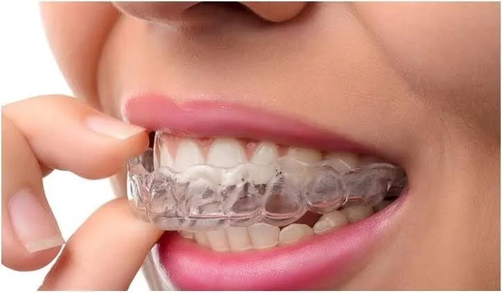 ግልጽ የጥርስ ማስተካከያ Treatment at Green Life Dental